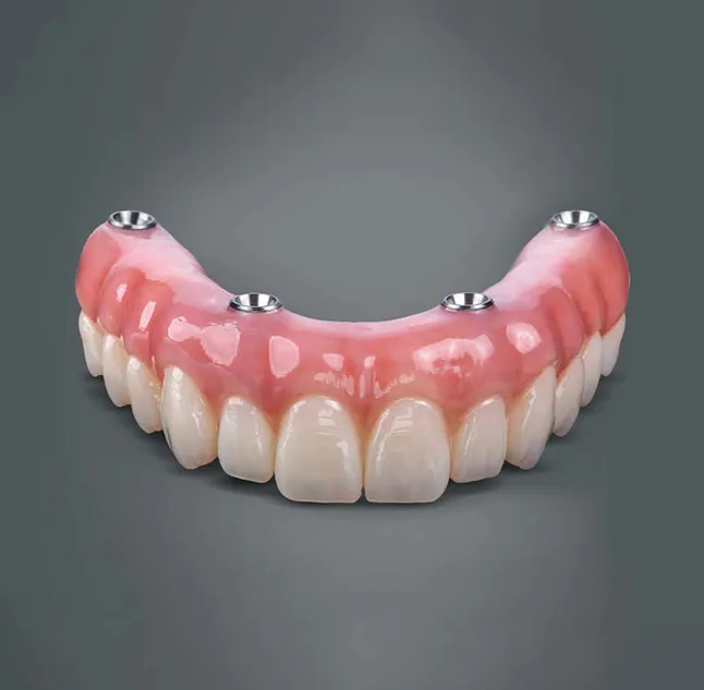full mouth restoration by dentist arcadia