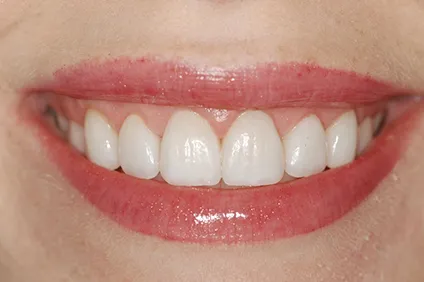 healthier smile by dentist arcadia - After